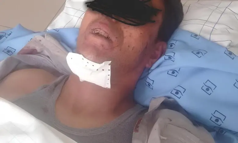 عسكري يبتر العضو التناسلي لرجل ضبطه مع زوجته % عسكري يبتر العضو التناسلي لرجل ضبطه مع زوجته
